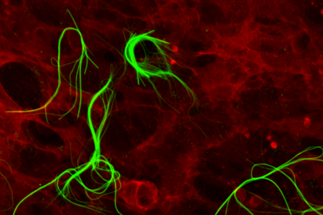 Nanostructures are growing inside a human cell (credit: CNR, IIT)