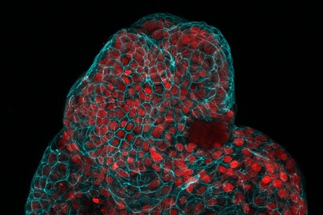 Lung organoid (credit: : Giuseppe Calà, Paolo De Coppi e Mattia Gerli)