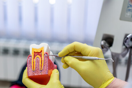 Dentista che spiega l'aspetto della cavità dentale. Paradontite denti Foto: bluecinema - iStock