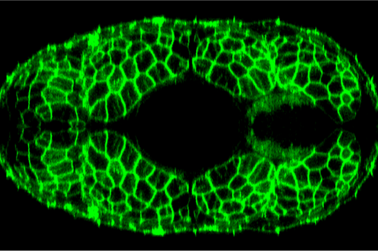 Cellule dei muscoli del pesce zebra, rese fluorescenti (fonte:&nbsp;King's College London)
