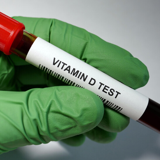 Il test della Vitamina D. Fonte: Hailshadow - iStock