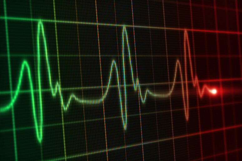 Elettrocardiogramma - RIPRODUZIONE RISERVATA
