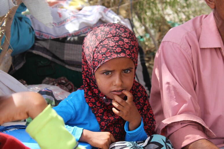 Yemen: Save Children, sempre pi grave malnutrizione bambini - RIPRODUZIONE RISERVATA