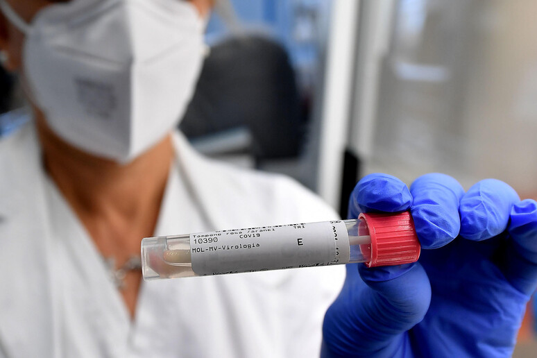 Coronavirus: laboratorio analisi a Torino - RIPRODUZIONE RISERVATA