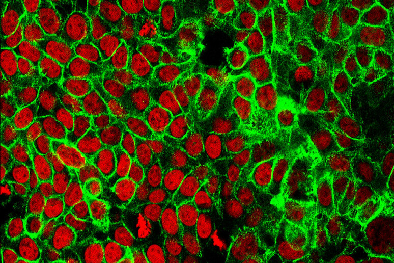 Cellule del tumore del colon-retto (fonte: NCI Center for Cancer Research) - RIPRODUZIONE RISERVATA